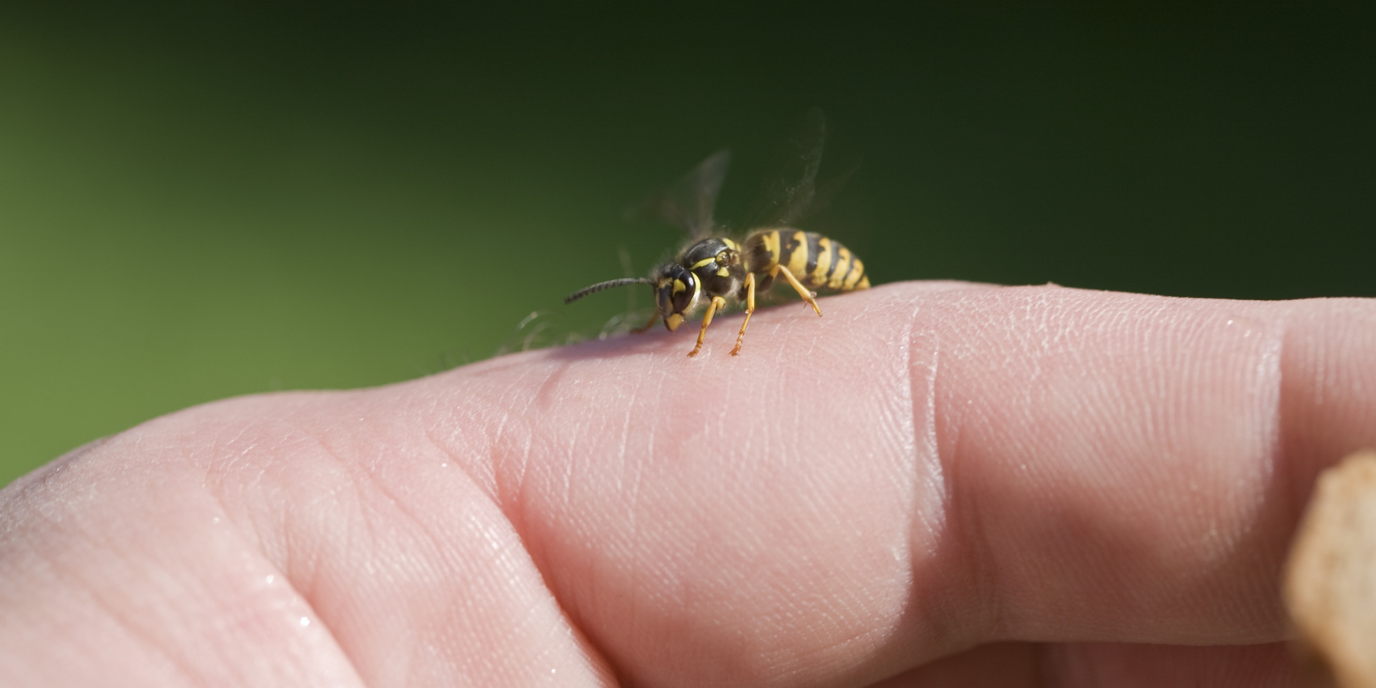 how-to-treat-a-bee-sting-self-care-instructions-goodrx