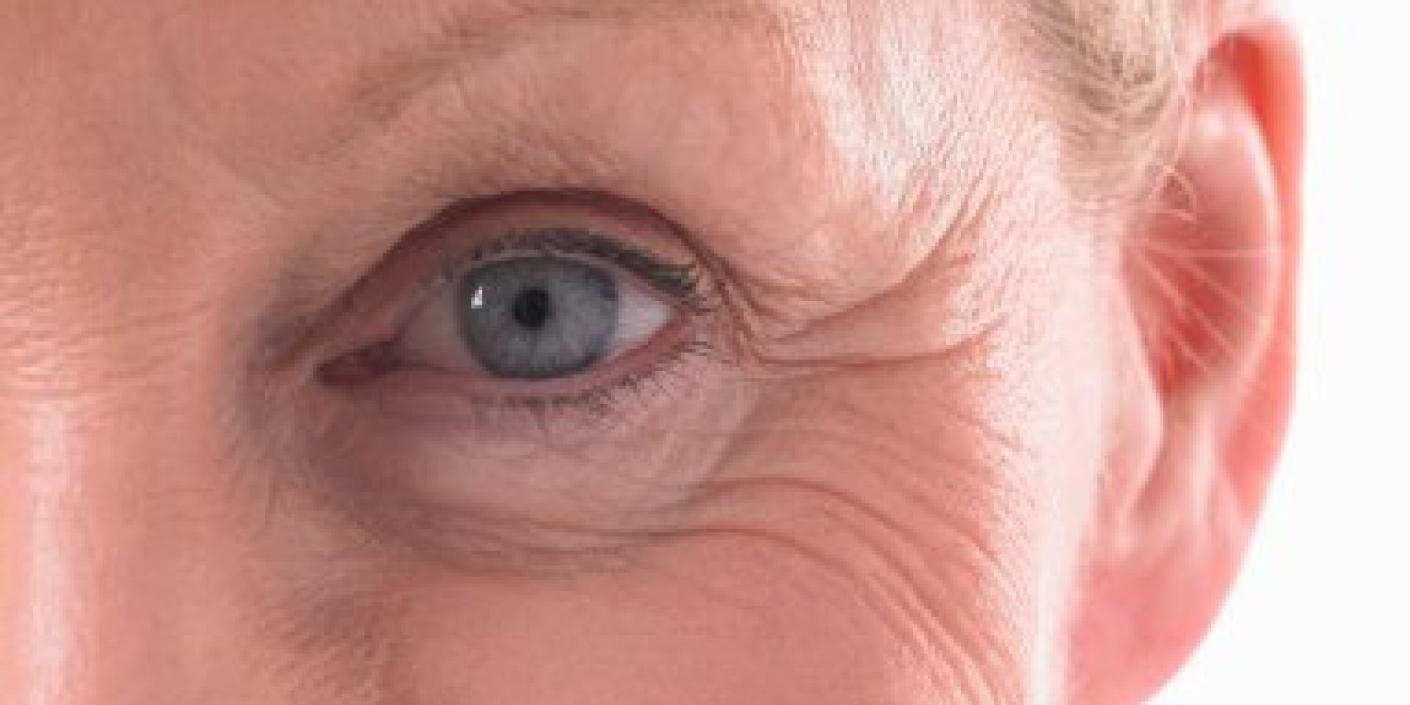 Image result for wrinkled skin