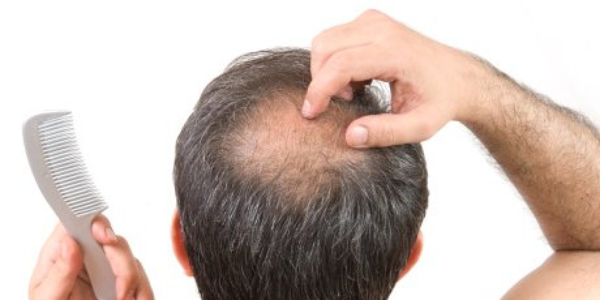 3 Easy Ways To Avoid Hair Loss And Promote Hair Regrowth Quickly!