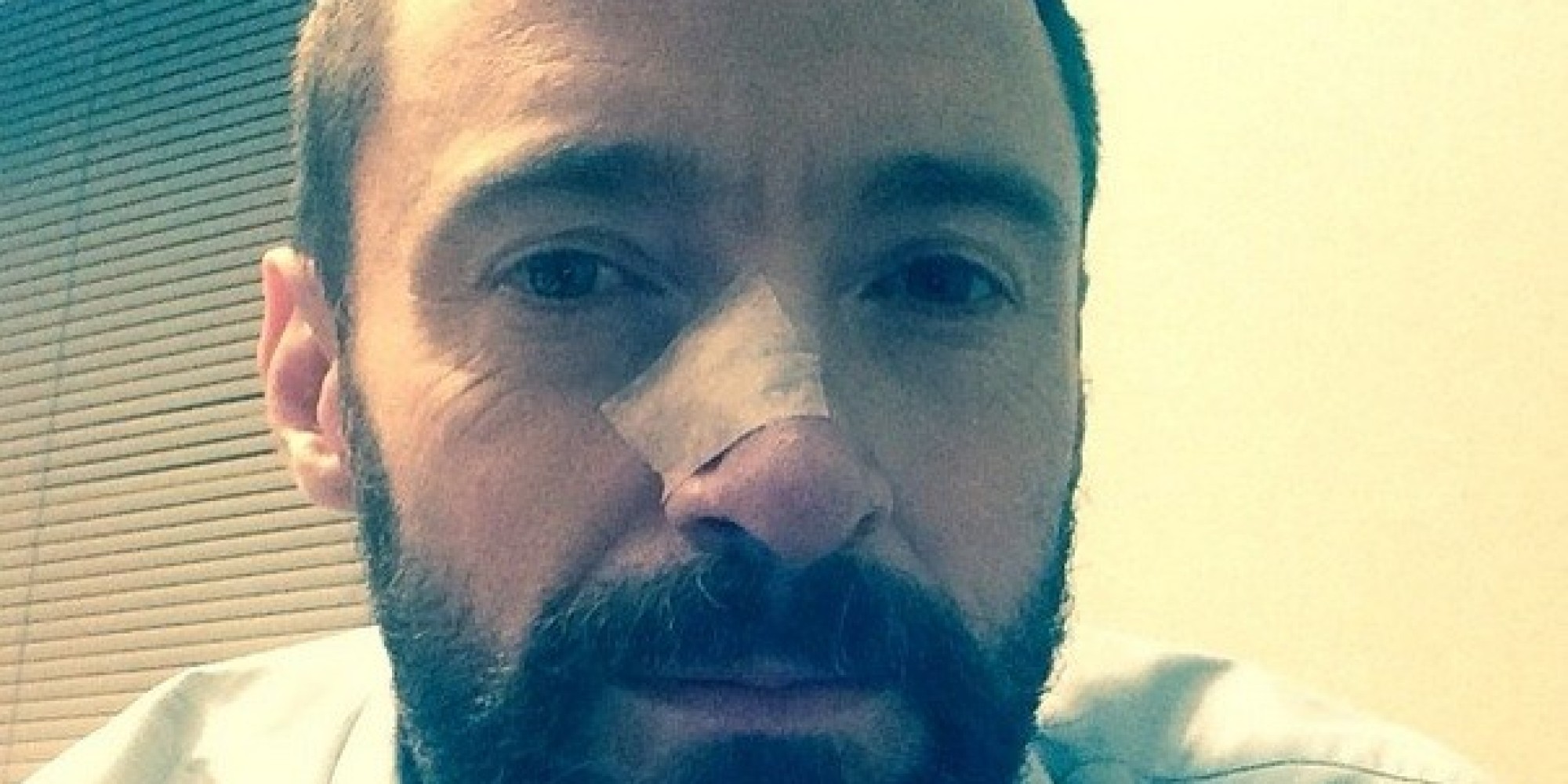 Hugh Jackman's Skin Cancer Returns; Actor Receives Treatment For Basal