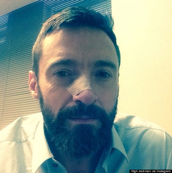 jackman
