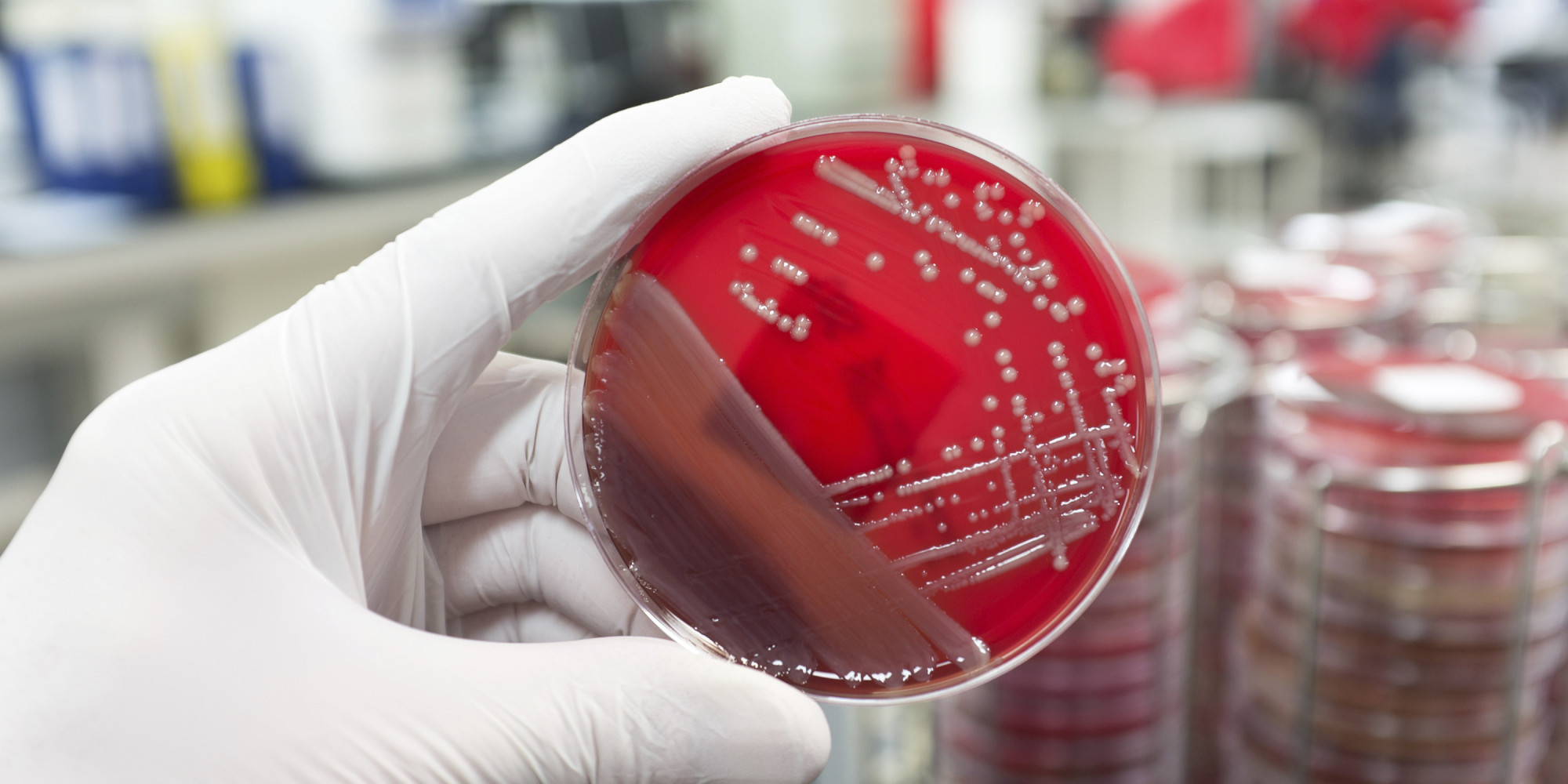 superbug-threat-is-as-grave-as-climate-change-scientists-say-huffpost