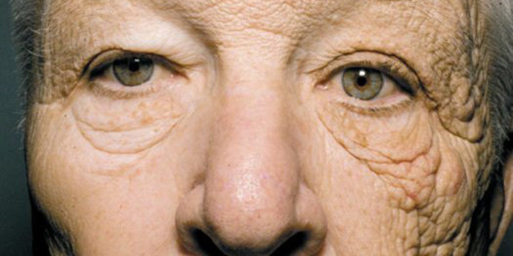 Siccome è corretto per usare la crema di decolorazione di faccia