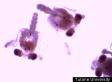 Scientists Find Evidence That Oil And Dispersant Mix Is Making Its Way Into The Foodchain