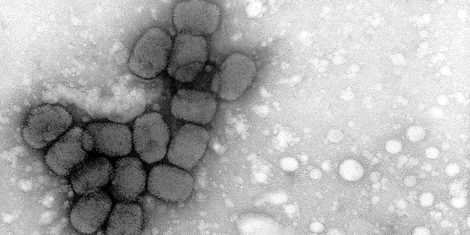 CDC: Smallpox Virus Samples Found In Lab Are Live | HuffPost