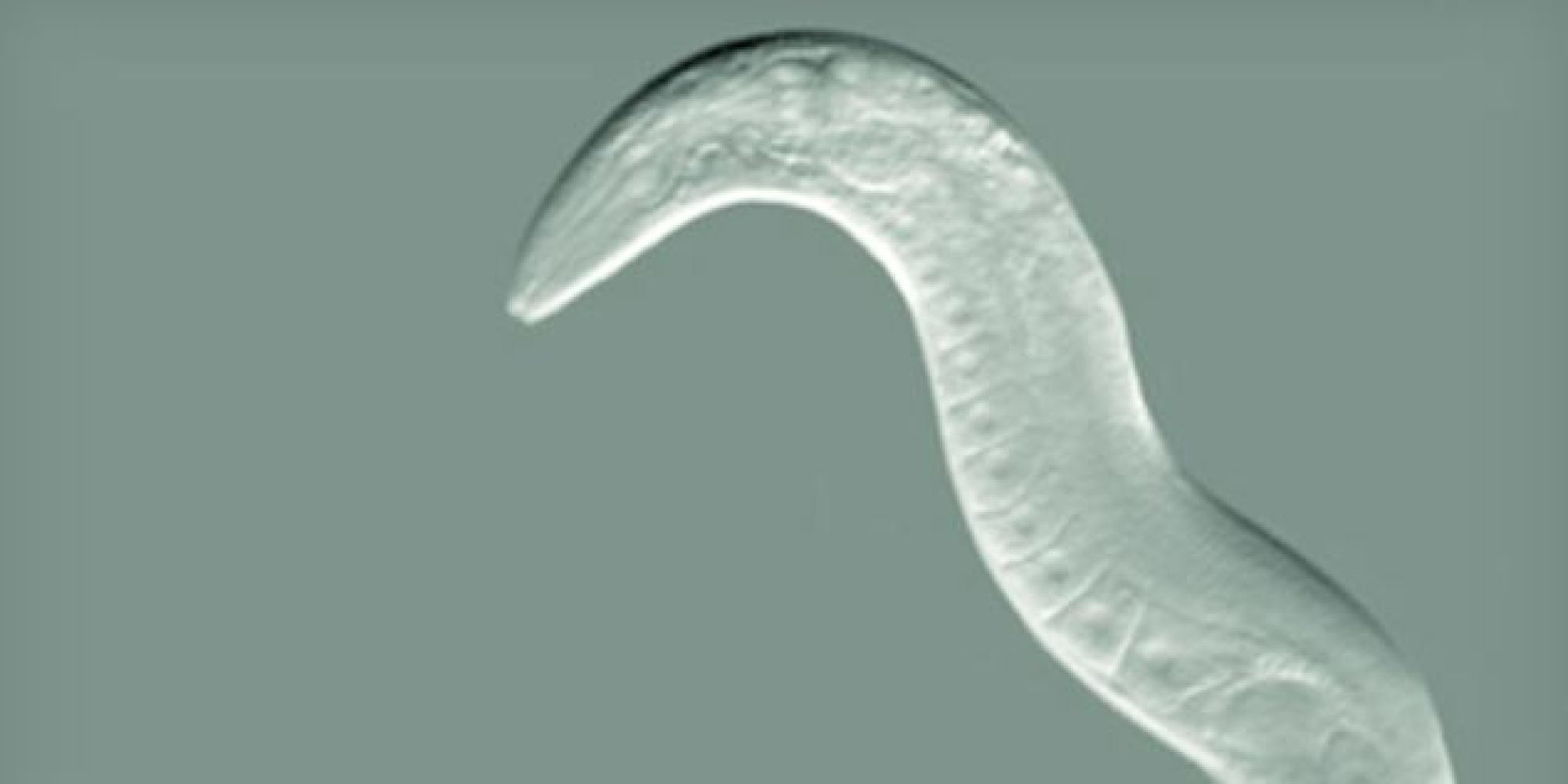 Mutant Worm Doesn't Get Drunk, Could Lead To AlcoholProof Humans