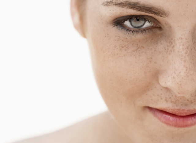 Les taches de pigment sur le corps vitiligo