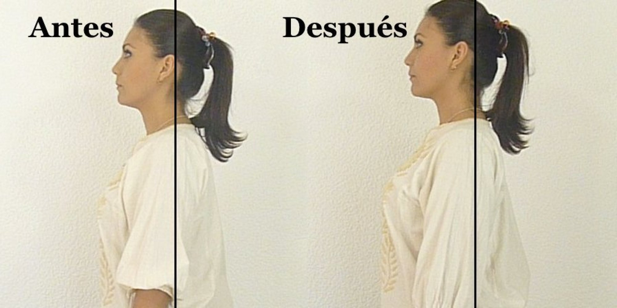 Si puede ser la jaqueca de la osteocondrosis