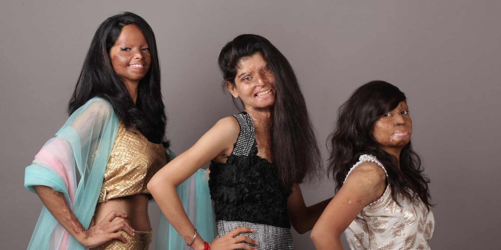 Indian Acid Attack Victims Bravely Star In Empowering Photoshoot