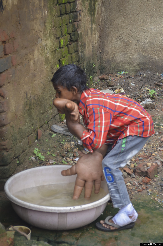 boy with giant hands
