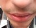 Justin Bieber Thinks You Care If He Shaves His 'Mustache,' Because Narcissism