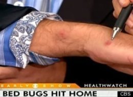carl leibowitz bugs bed hospitalized due alerts
