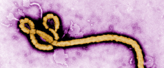 EBOLA