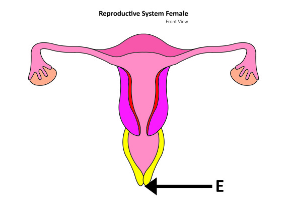 vaginal cancer types
