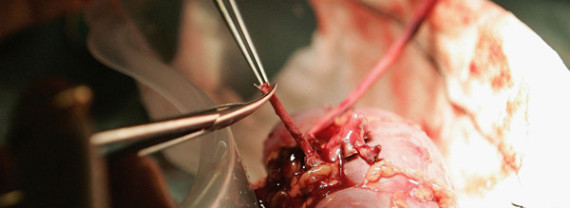 Kidney