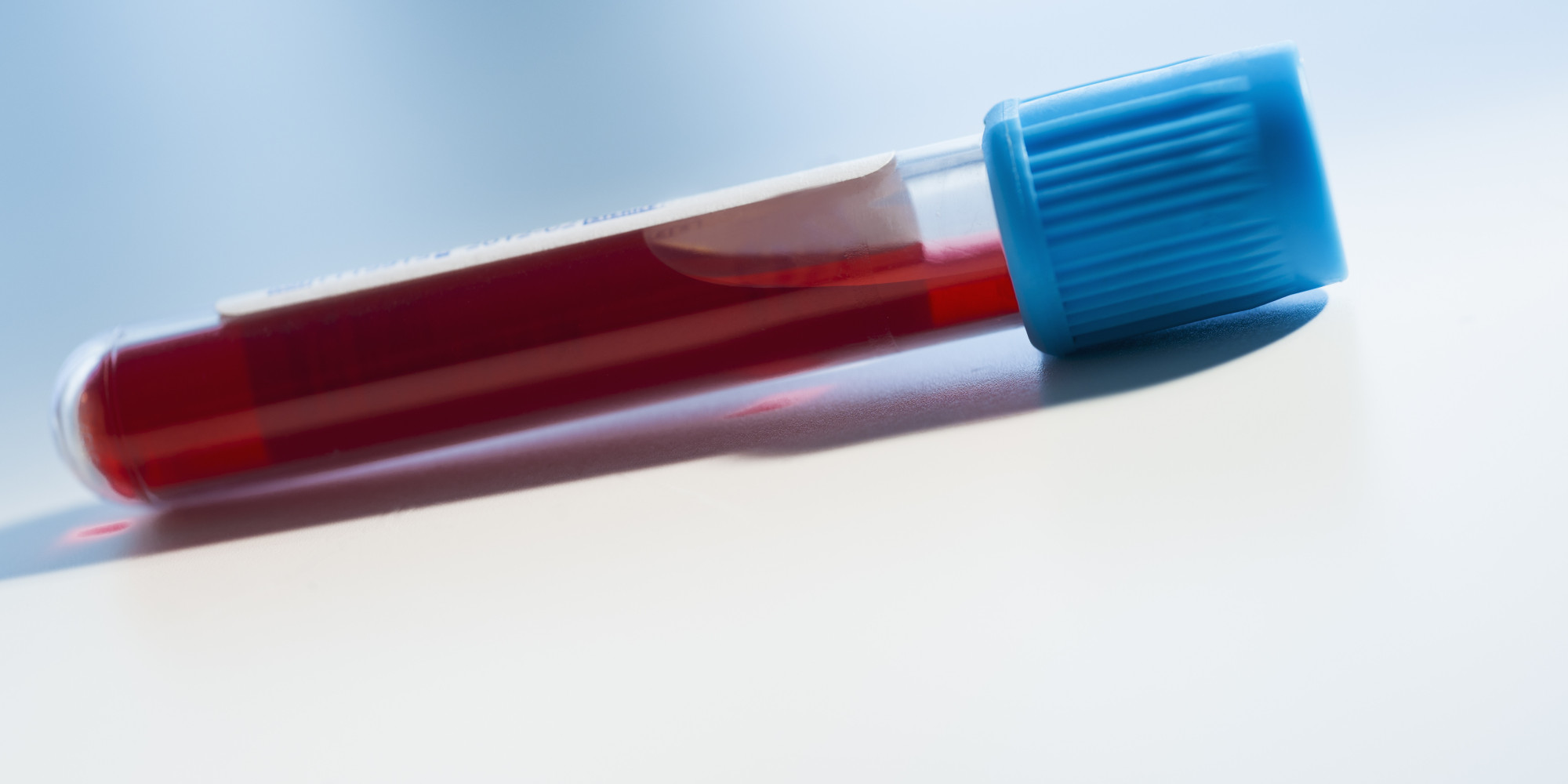 WHO Urges Use Of Drugs Derived From Blood Of Ebola Survivors HuffPost