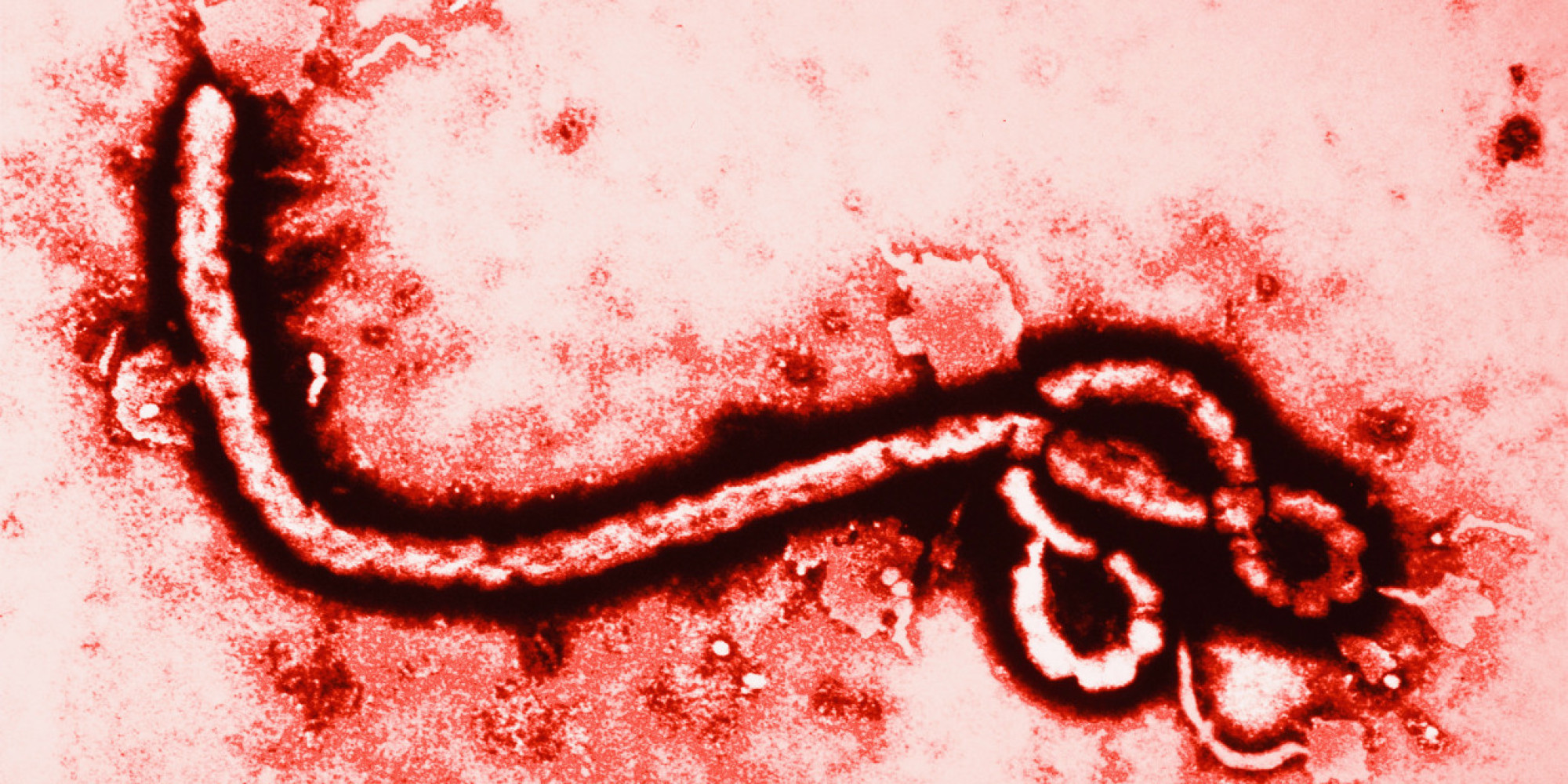 Is there Ebola in Chad, Africa?