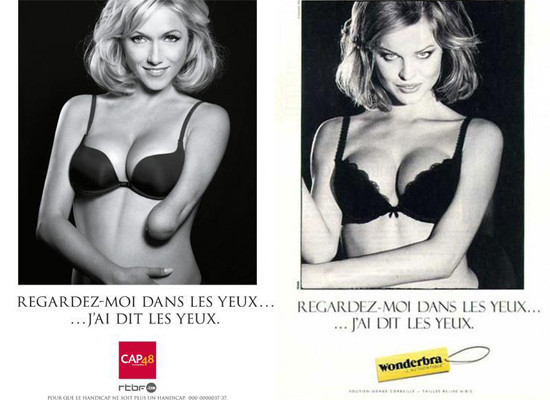 Eva Herzigova and Tanja Kiewitz's ad campaigns for Wonderbra.  Kiewitz is missing her hand.