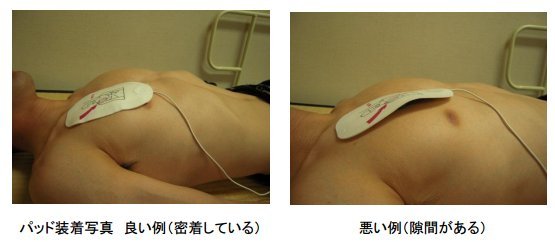 aedの使い方 悪い例