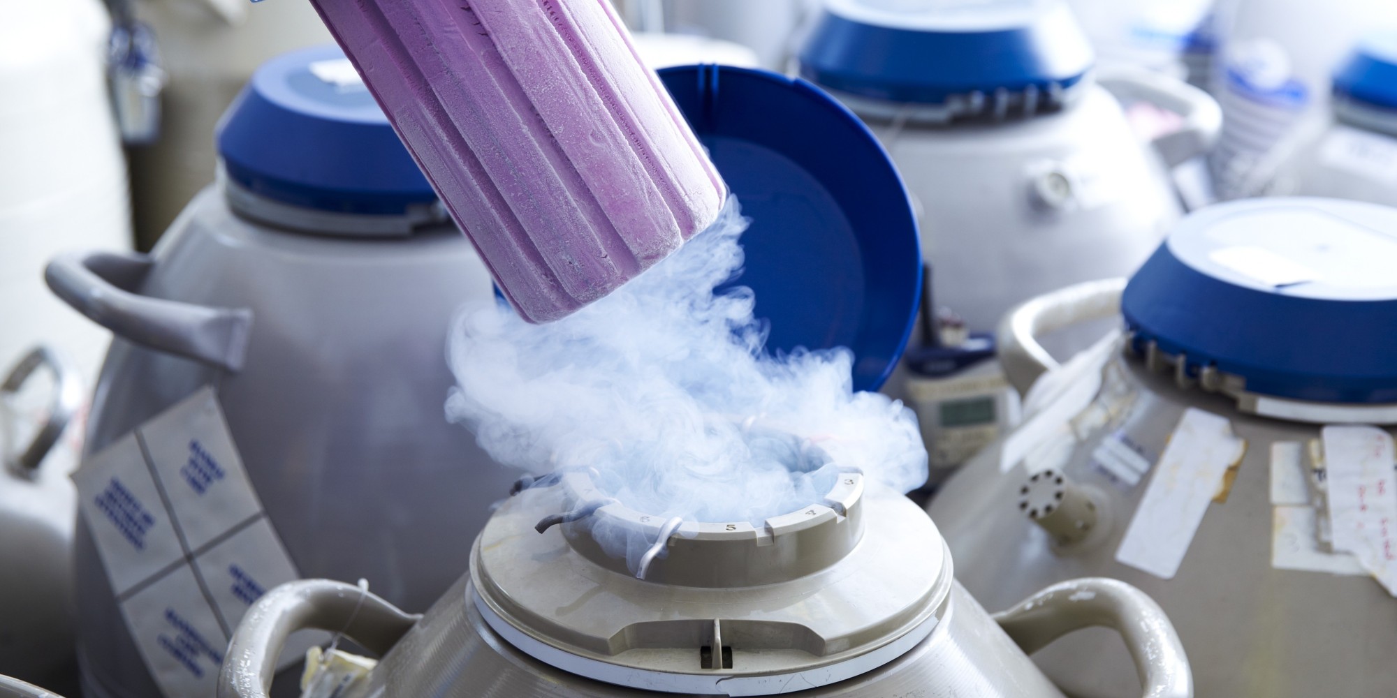 Egg Freezing Deserves Serious Consideration Dr. Sonya Kashyap