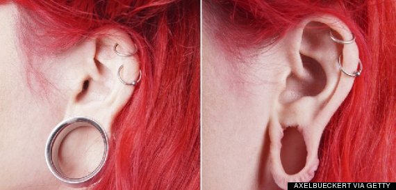 Cosmetic Surgery To Repair Stretched Earlobes Aka Flesh Tunnels Is On The Increase 0258