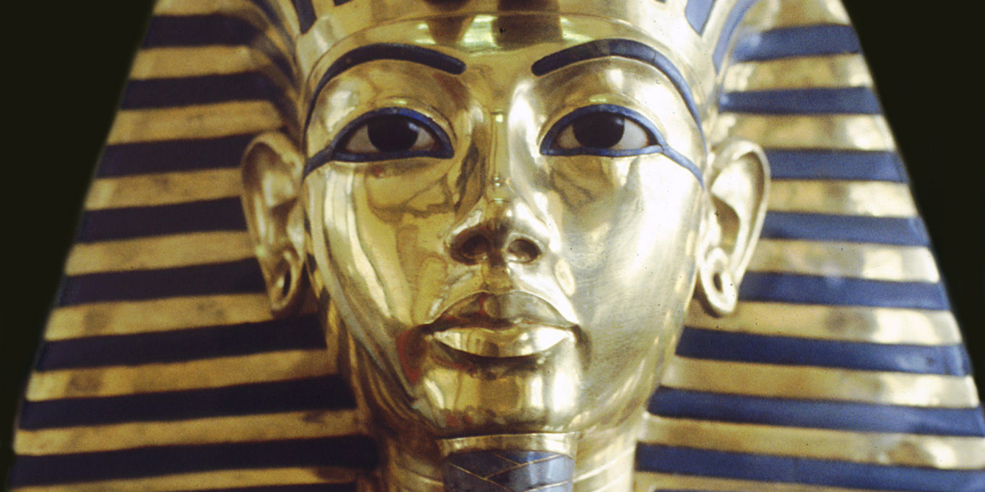 King Tut Had A Club Foot And Other Deformities, New