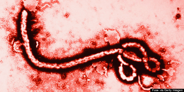 Breakthrough 15-Minute Ebola Test Approved