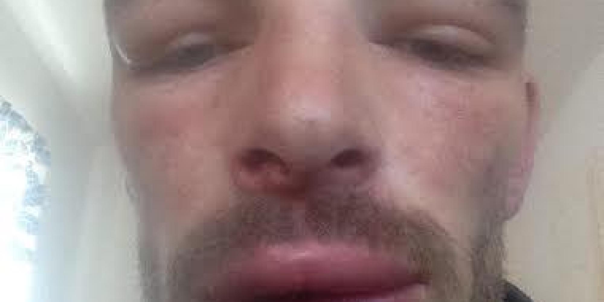 'I Could Have Died' Man With Flu Suffers Alarming Reaction To