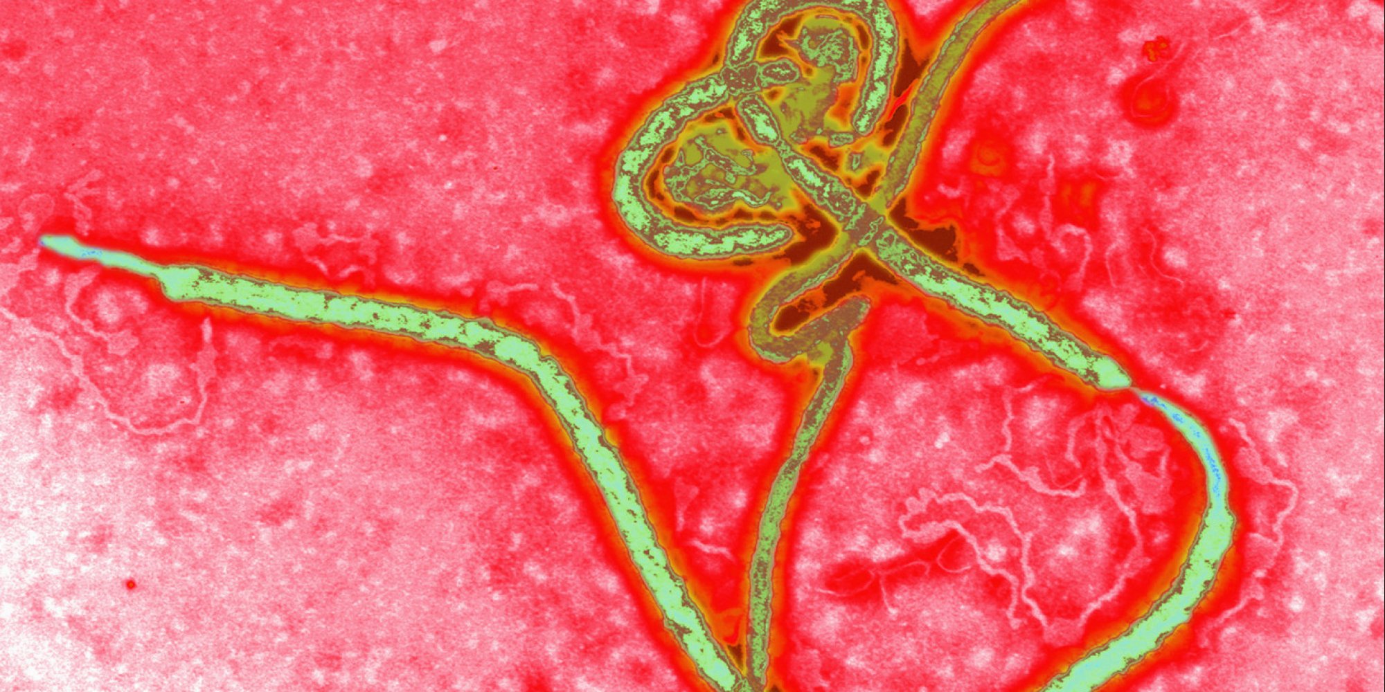 Oregon Woman Hospitalized For Possible Ebola Infection | HuffPost