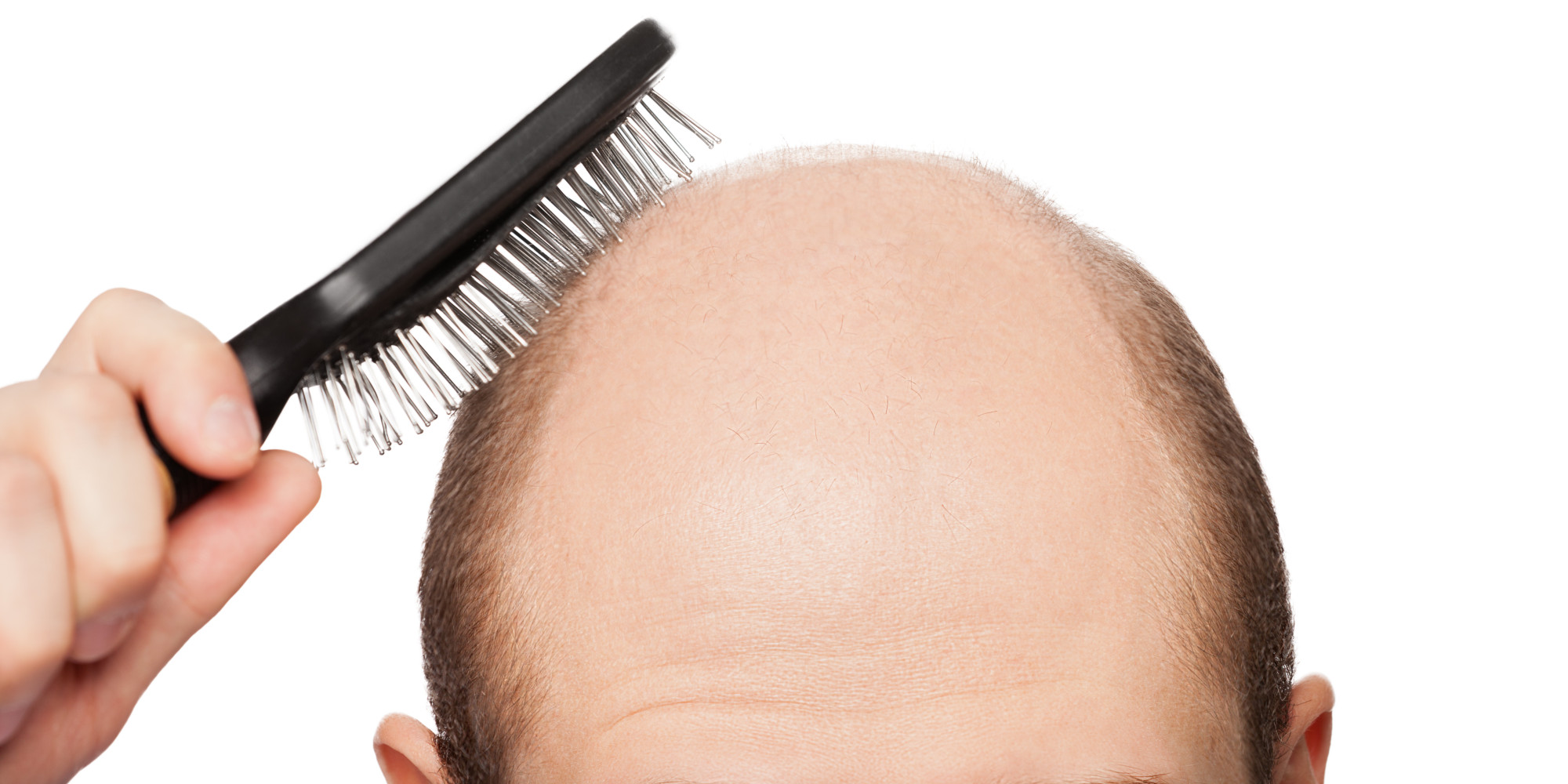 The Truth About Hair Loss And Baldness Cures HuffPost