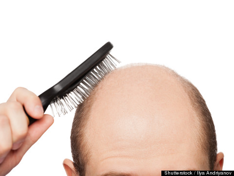 The Truth About Hair Loss -- And What Can Help Stop It
