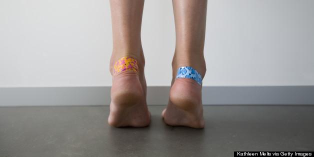 Is It Ever OK To Pop A Blister?