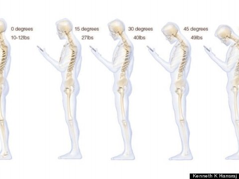 Staring At Your Phone All Day Is Killing Your Back, Study Finds