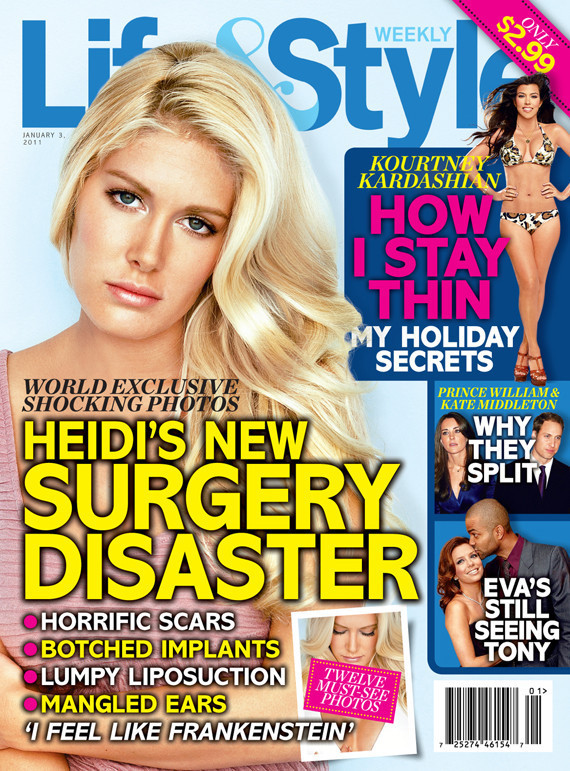 pictures of heidi montag scars. Heidi Montag Reveals Plastic