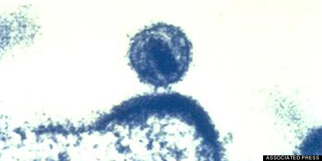 Only 3 In 10 Americans Have HIV Under Control