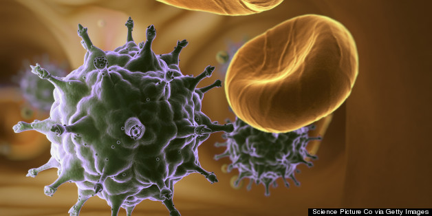 HIV's Ability To Cause AIDS Is Weakening Over Time