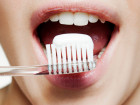 The Truth About All-Natural Teeth Whiteners