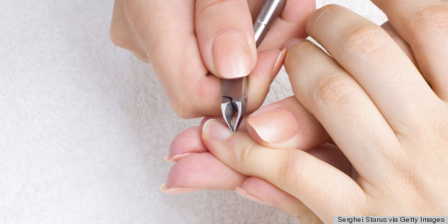 Your Questions About Hangnails Answered