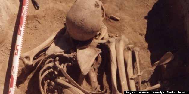Is This The World's Oldest Case Of Cancer?