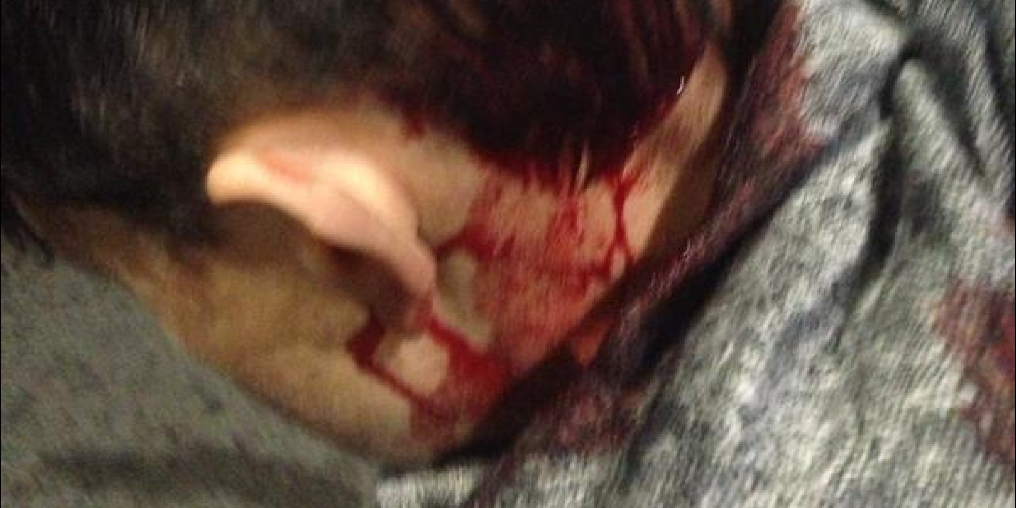 Minister Says Police Split Open Her Head During Berkeley Protests - Huffington Post