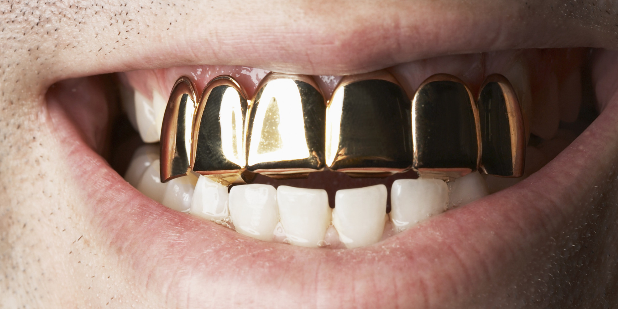 Salvation Army Concerned That Gold Tooth Donation Was Unintentional