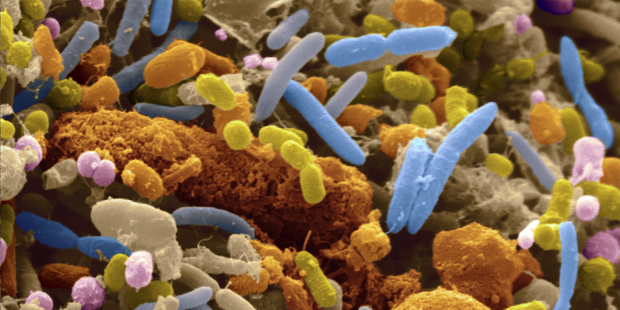 Gut bacteria and anxiety