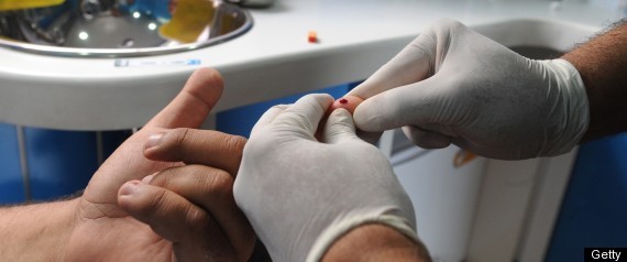 Std Tests Medicaire