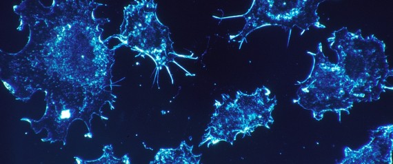 n-CANCERCELLS541954_1280-large570.jpg