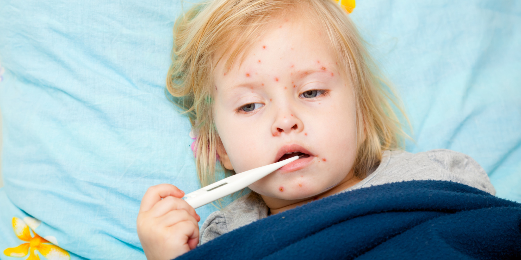 Measles A Rising Public Health Threat The Huffington Post measles-a-rising-public-health-threat-the-huffington-post