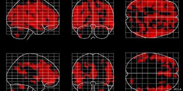 Study Says Meditation Could Protect The Brain From Signs Of Aging