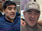 ¿Qué se hizo Maradona en la cara?