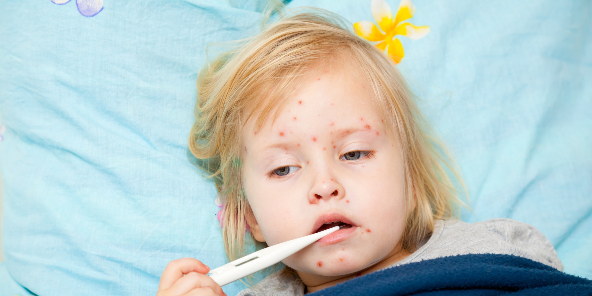 Do Not Bring Your Kids To 'Measles Parties,' Doctors Warn HuffPost