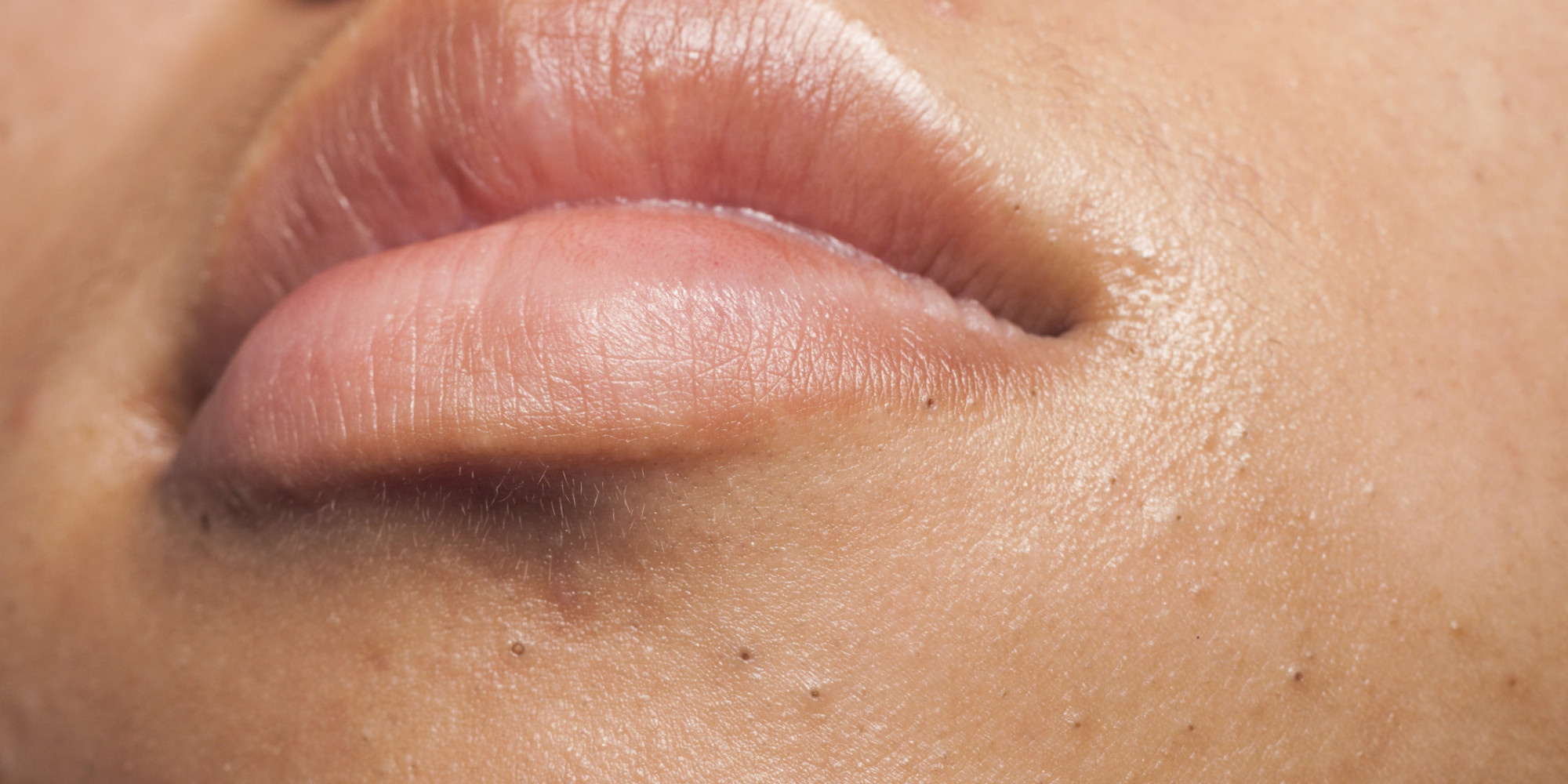 End Blackheads With These Genius Skin Tricks Huffpost 2382