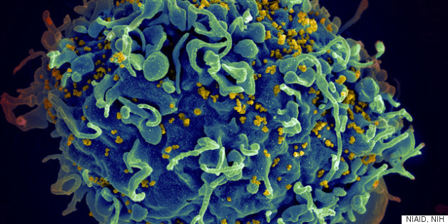 HIV 'Vaccine' Stirs Excitement